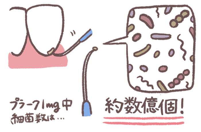 プラークには菌がいっぱい